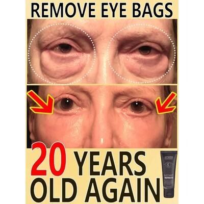 New Anti Wrinkle Eye Cream Remove Eye Bags Puffiness Lifting