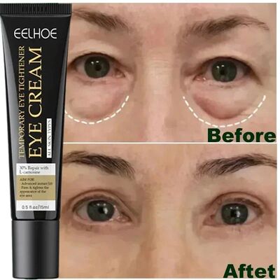 7 Day Remove Eye Wrinkles Eye Cream Lifting Firming Fat Bags