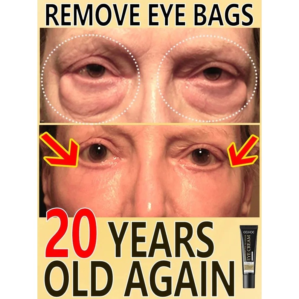 7 Day Tighten Wrinkles Eye Cream Remove Eye Fat Bags Puffine