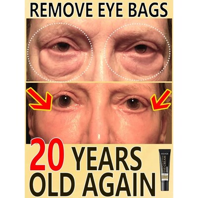 7 Day Tighten Wrinkles Eye Cream Remove Eye Fat Bags Puffine