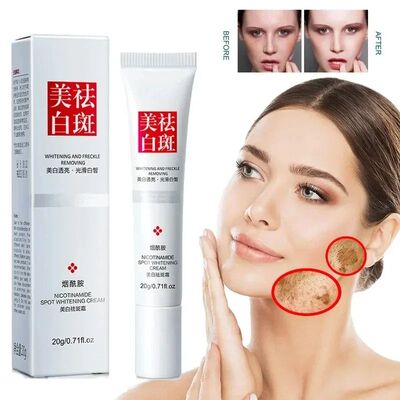 Fades Freckle Dark Spots Face Cream Niacinamide Whitening Cr