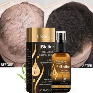 Biotin Fast Hair Growth Spray Anti Hair Loss Serum Prevent B