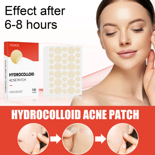 144pcs/set Face Men Women Skin Care Acne Pimple Patch Remove