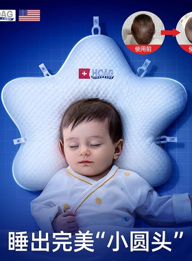 霍格Hoag海星定型枕婴儿0到6-12个月矫纠正头型宝宝枕新生儿枕头