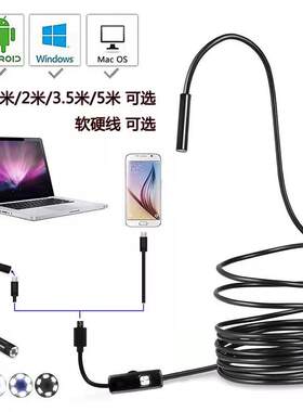 内窥镜阴道连接手机外置摄像头高清耳鼻喉探头女用的水私处窥阴器