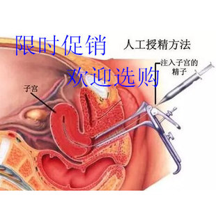 人工受精助孕器生殖工具家用备孕授精辅助用品医用硅胶输精管辅助