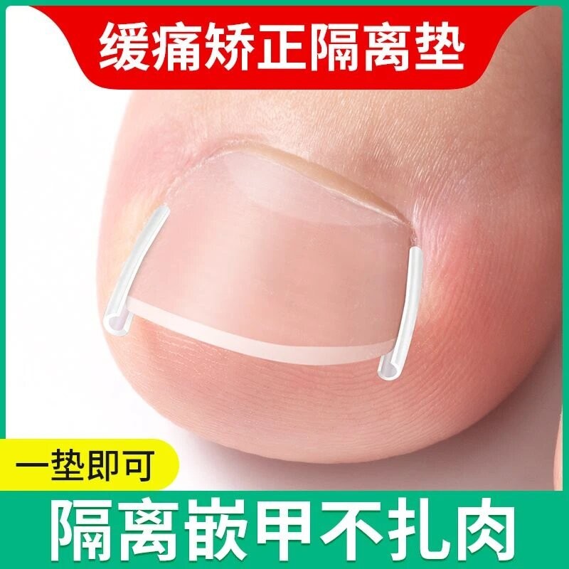 甲沟神器指甲矫正器嵌甲专用隔离填充垫片脚趾甲往肉里长治疗工具