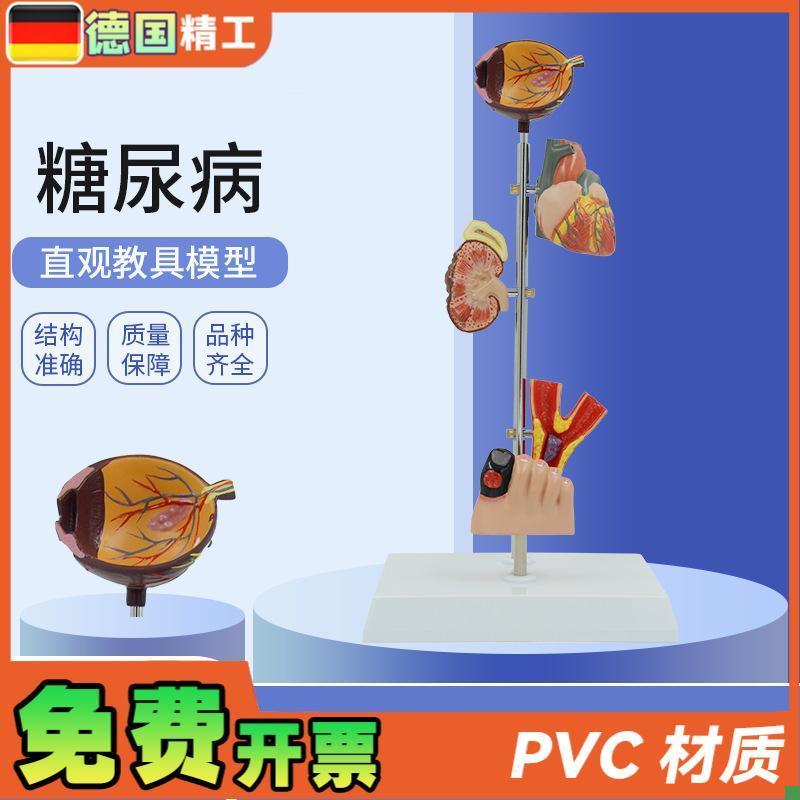 德国】人体医学糖尿并发q症眼睛心脏肾脏血管足内外科康复病理演