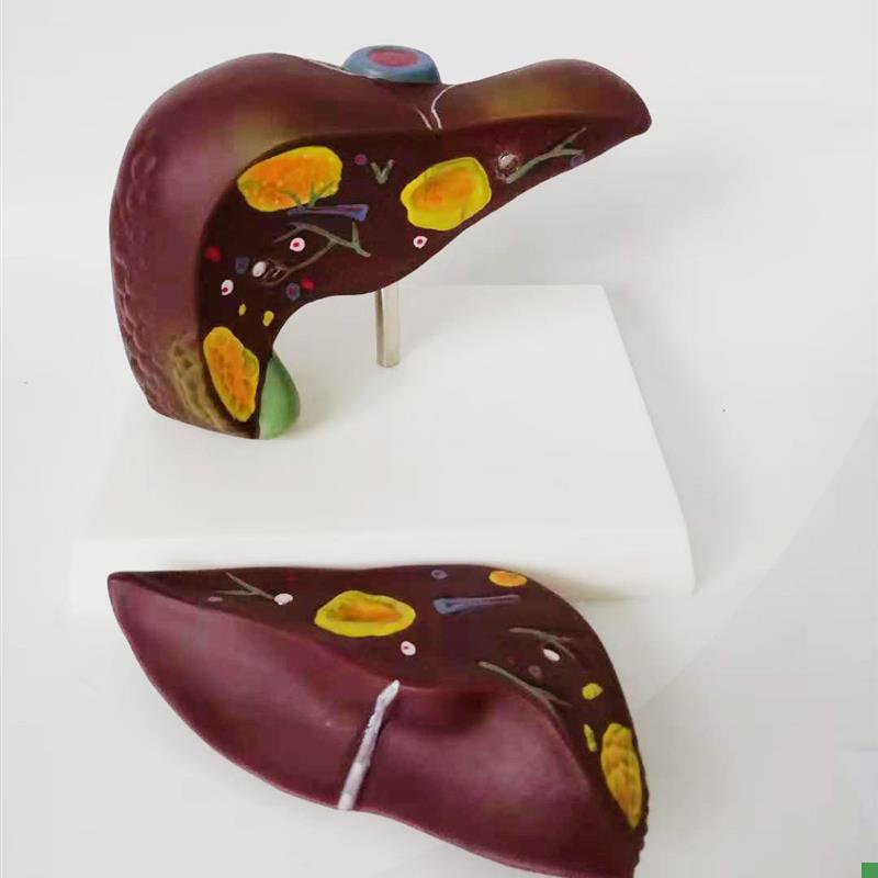 人体正常肝模型肝结构模型肝脏解剖医用教具Q人体医学教学教仪