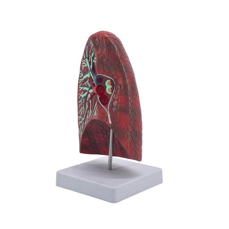 肺解剖模型人体内脏健康肺模z型教学用人体器官正常肺解剖模型