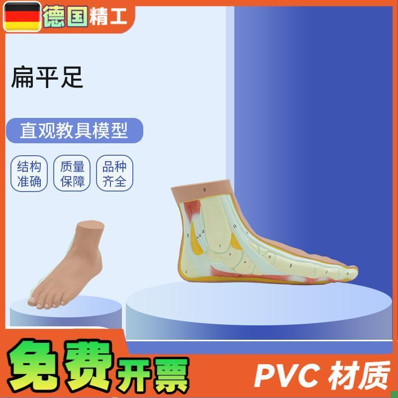 德国】PNT-0728扁平足直y观教具平底足弓塌陷模型脚关节解剖模