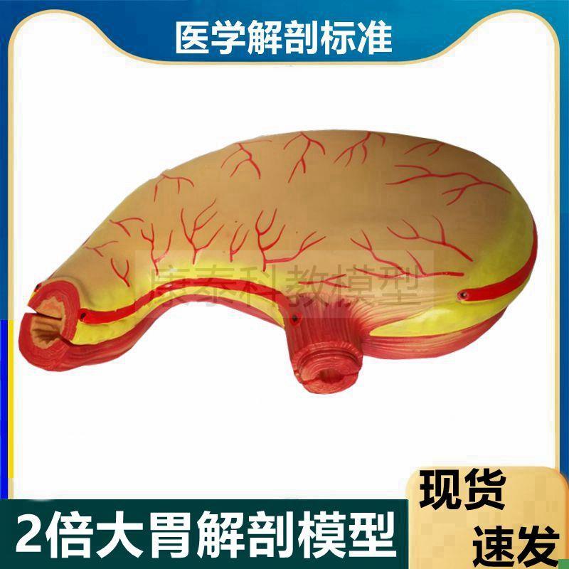 胃解剖模型放大2倍n可拆卸生物课医临床解剖病理粘膜穿孔食管病变