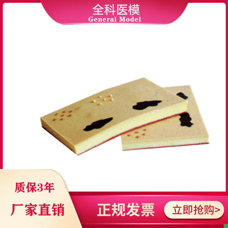 表皮常见病表处理训练模块GM/TW00103