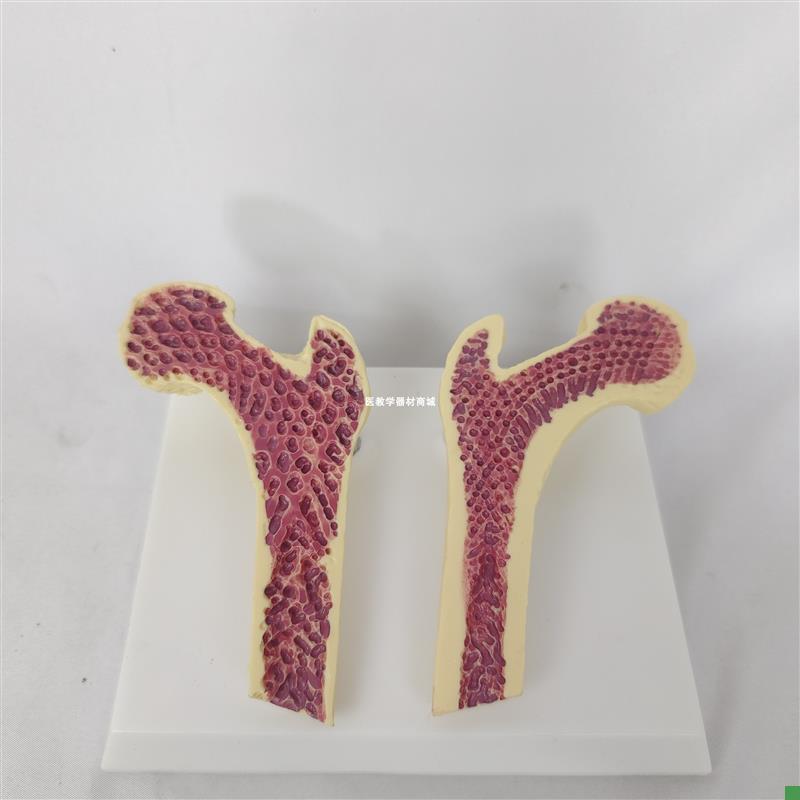 人体股骨头病变骨质疏松解剖切面演示模型骨科Q讲解教具骨骼骨架