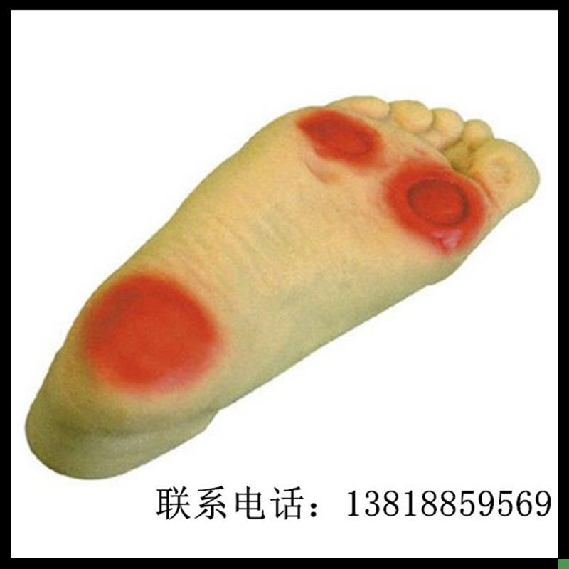 高级糖尿病足护理模型GS19糖足护理模型