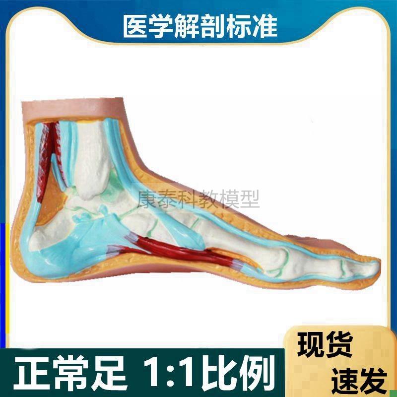 脚模型正常扁平弓形畸q形足解剖脚底功能康复足骨仿真健身教学用