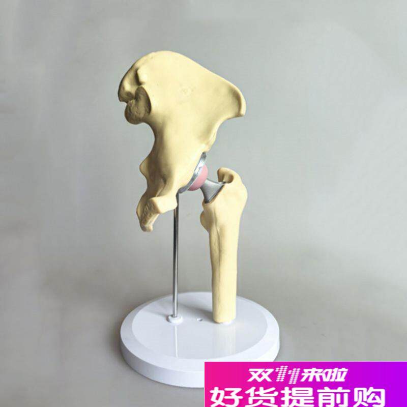 人工髋关节模型假肢替换股骨头置换临床J骨科手术教学术前实操展
