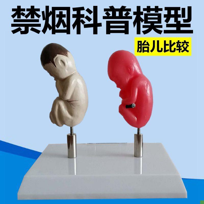 禁烟警示模型吸烟有害健康脏器功能受损妊娠期S胎儿女性戒烟教育