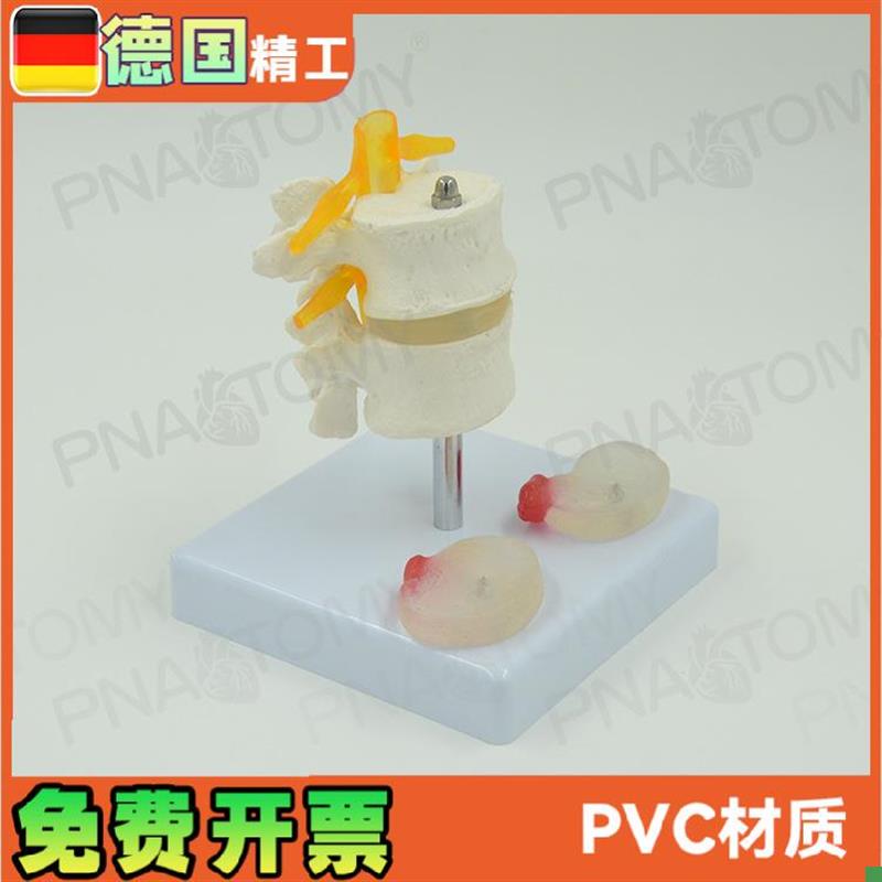 德国】人体腰椎盘突出模型两节腰椎骨骼J骨科推拿演示教学医学模