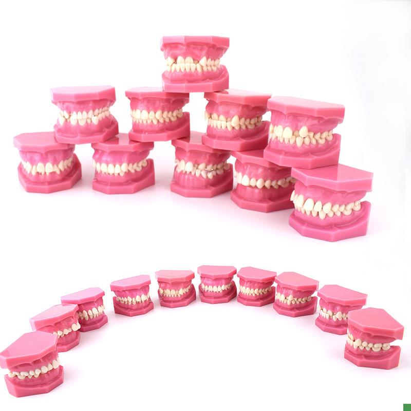 ENOVO颐诺安氏错颌分类模型xANGEL分类错颌畸形分类演示模型口腔