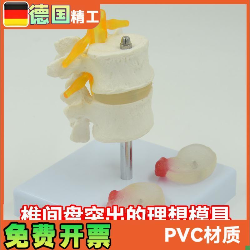 人体腰椎模e型椎间盘脊神经根骨骼解剖医药礼品教学展示用道具
