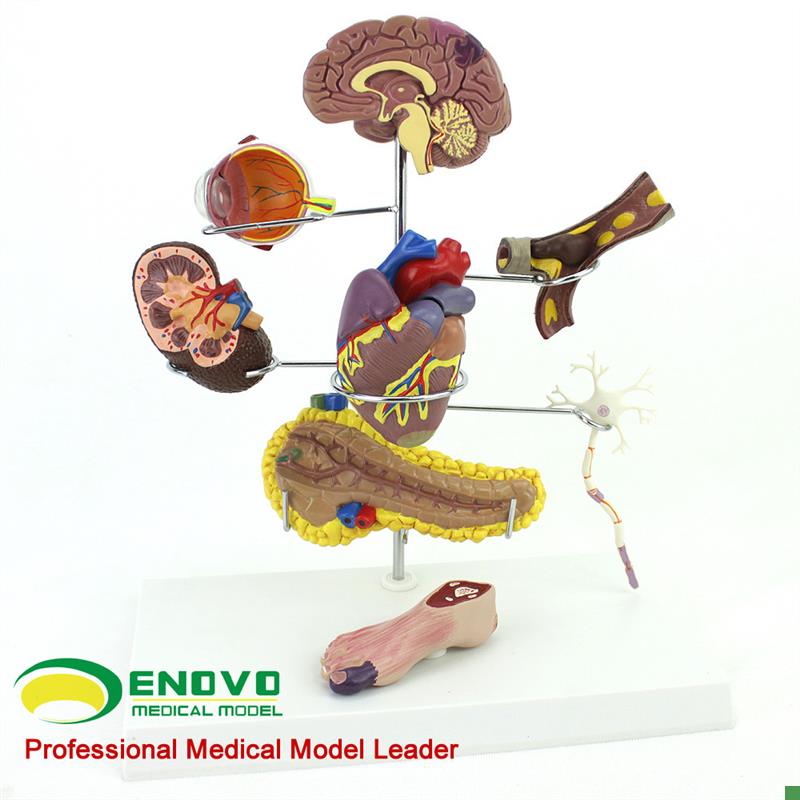 ENOVO颐诺人体医学糖s尿病模型糖尿病并发症大脑心脏胰腺神经元足