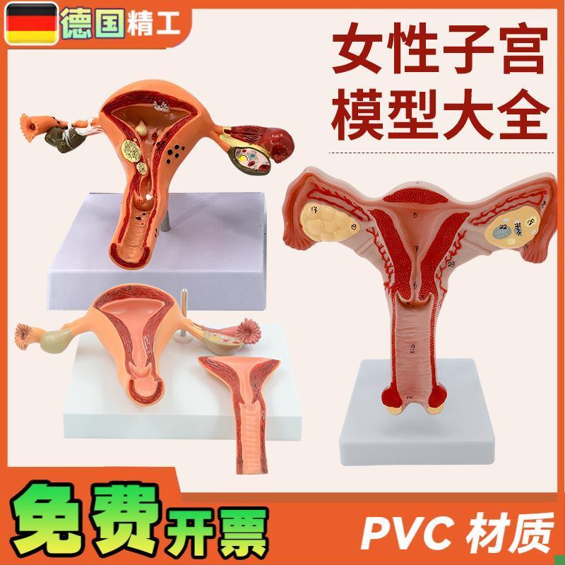 病理子宫模型女妇产子宫结构解剖仿真病态子宫X模型示教模型