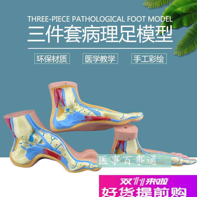 正常的足部正常足表层结构肌肉韧带人体骨骼S关节模型示教模型