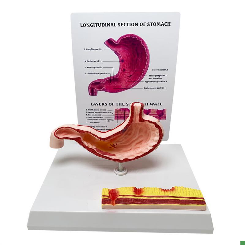 胃解剖模型胃腹腔病态解剖模C型结构人体教学教具人体解剖