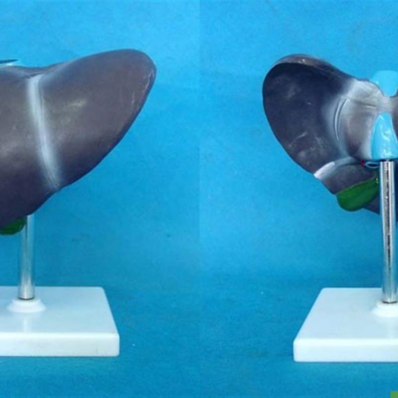 人体自然肝解剖模型x器官解剖医用教学标本讲解