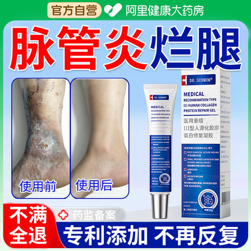 DR.SUNMOM脉管炎老烂腿专用