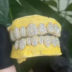 S925 Silver with Zircon Inlay and Full Diamond Gold-Plated Dental Braces