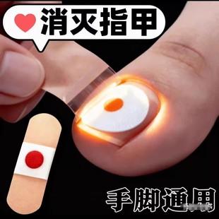 香港房灰手脚贴正品百年品牌植物萃取脚趾手指甲专用可脚指甲养护