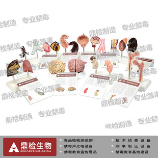 仿真吸毒前后人体器官模型心脏模型禁毒产品教学宣传仪器包邮