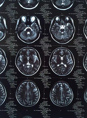 X光CT胶片代打印电影视小品道具服装幼儿园教学骨牙口腔科观灯片