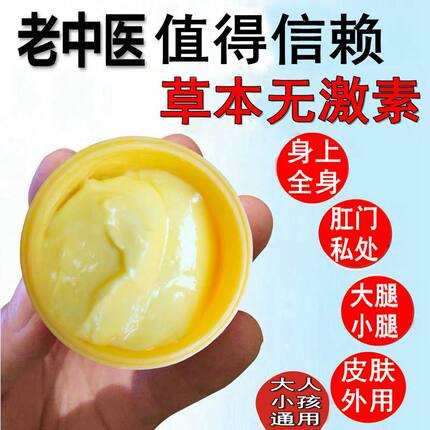 苗瑞堂肤草净小腿大腿内侧全身屁股私处肛门皮肤一热就痒外用膏痒