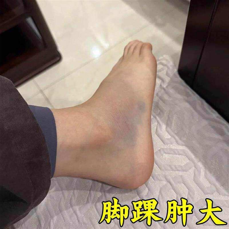 脚踝受伤崴脚走路扭伤脚踝热敷脚腕疼痛韧带拉伤恢复