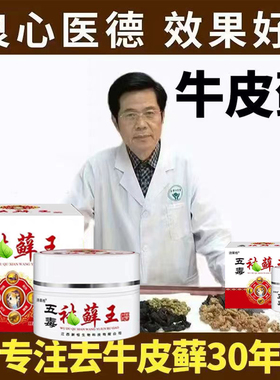 牛皮藓专用藓效特止痒膏湿藓头皮藓手足藓脚脱皮干裂真菌感染