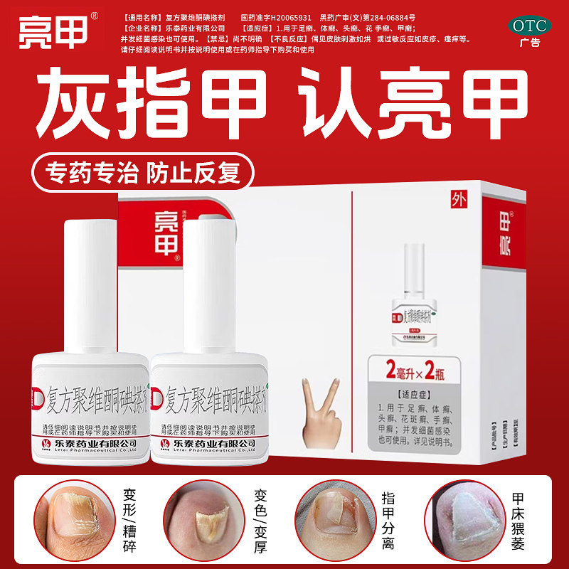 亮甲复方聚维酮碘搽剂 2ml*2瓶足癣体癣花斑癣手癣甲癣灰指甲