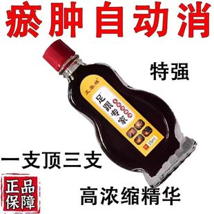 【足跟痛专用】藏医专家足底筋膜炎脚底板脚后跟疼痛跟腱炎腱鞘