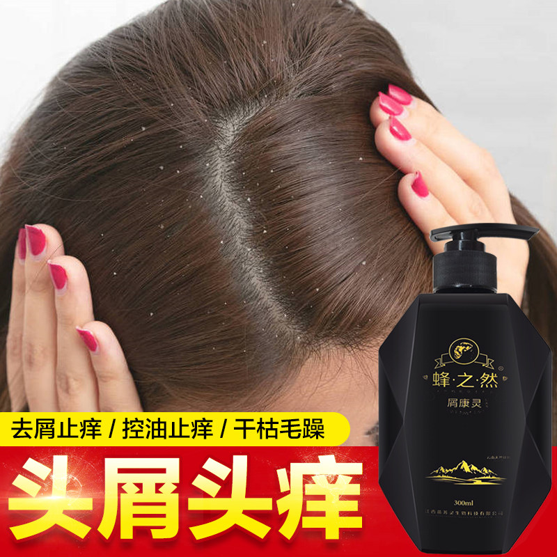 铍特舒屑康灵中药洗发水治头皮头屑头部头癣头皮毛囊专用脓包痘痘