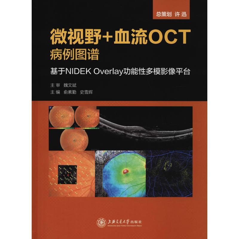 微视野+血流OCT病例图谱 基于NEK Overlay功能多模影像平台 俞素勤 著 正版书籍