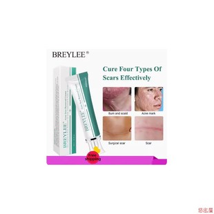 Acne Scar Removal Cream Face Repair Skin Whitening cream30g