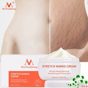 Skin Smooth Repair Cream Remove Stretch Mark祛妊娠纹霜身体乳
