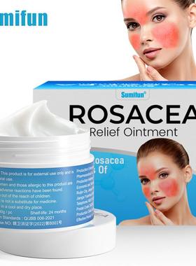 Acne Rosacea Fare Cream Nose Redness Removal Facial Redness
