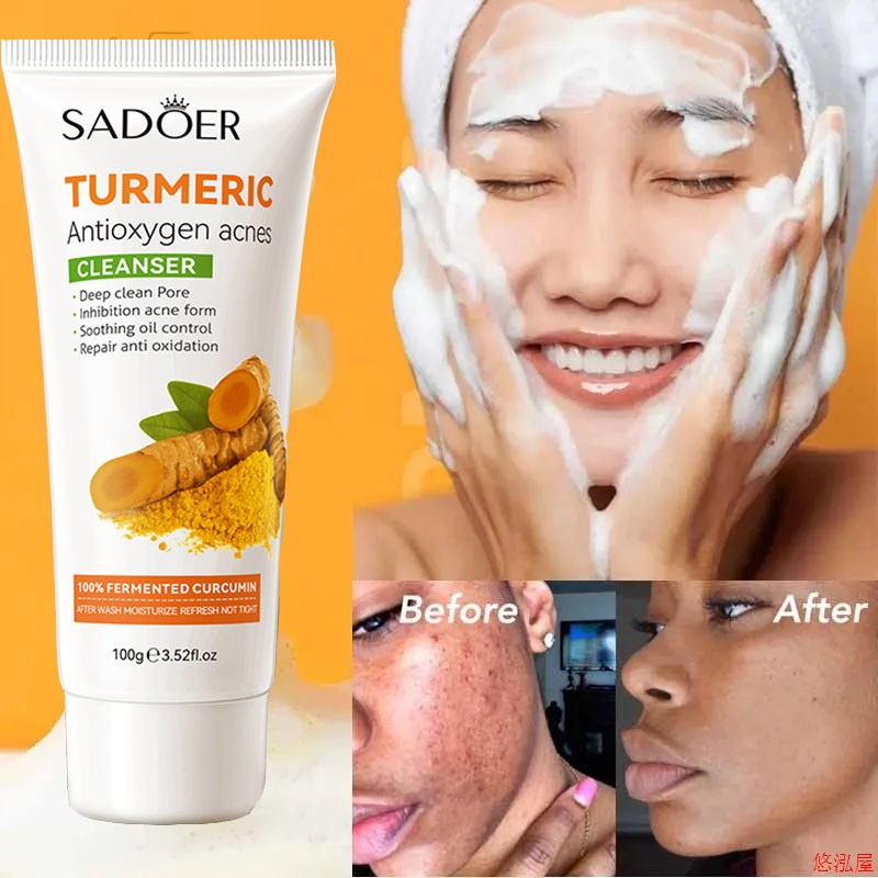 turmeric face cleanser wash gel blackhead acne spot洗面奶乳