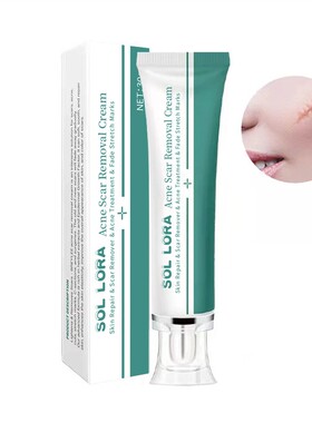 Acne Scar Removal Cream Face Repair Skin Whitening cream30g