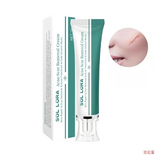 Acne Scar Removal Cream Face Repair Skin Whitening cream30g