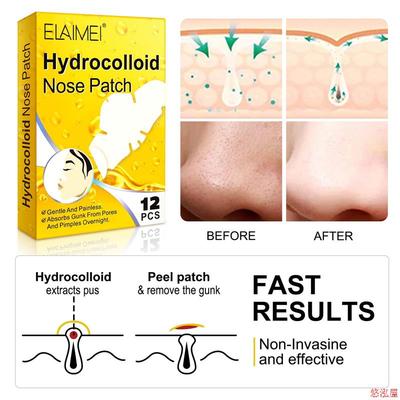 blackhead and acne removal nose patch for pores 去黑头粉刺