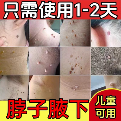 一天点好一周脱落快速去除